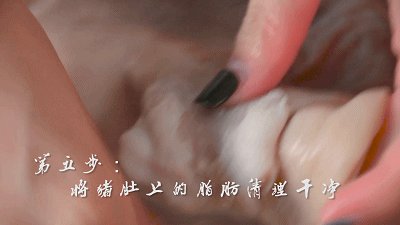 【小森妈妈备孕药膳】二肚滋阴助孕汤的做法步骤：5